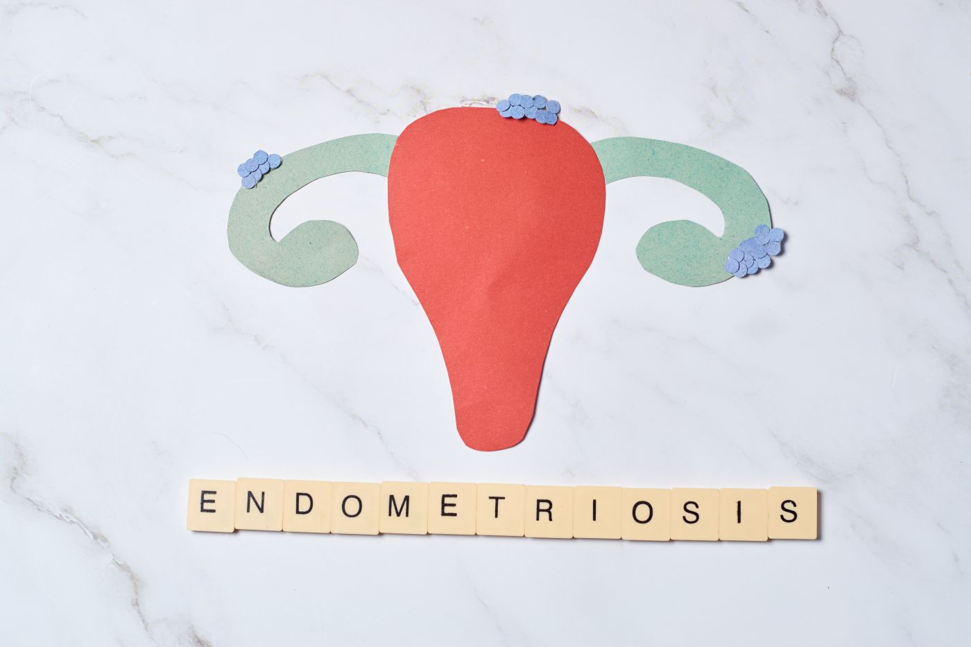 Endometrioza Dhe Shëndeti Mendor